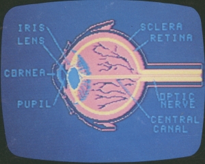 Eye Diagram by Uncredited